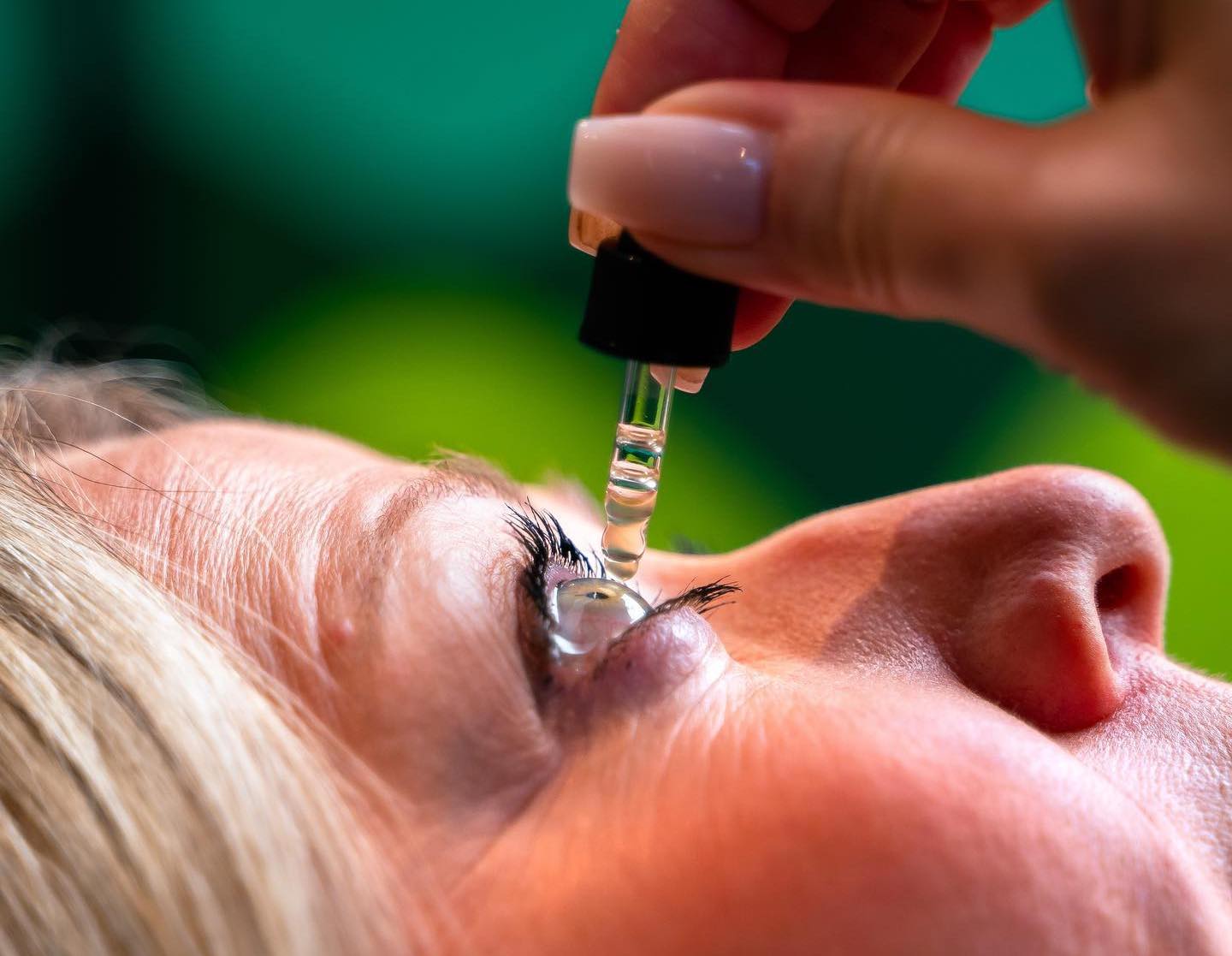 PRP eye drops for dry eye